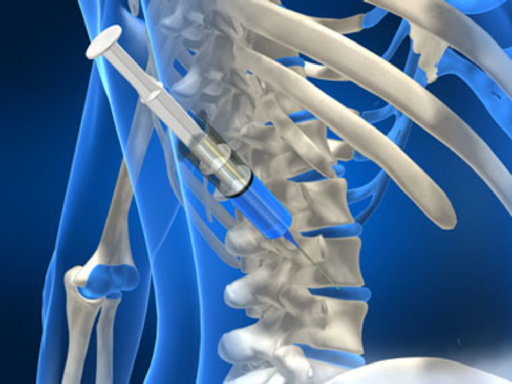 Interventional pain management adalah