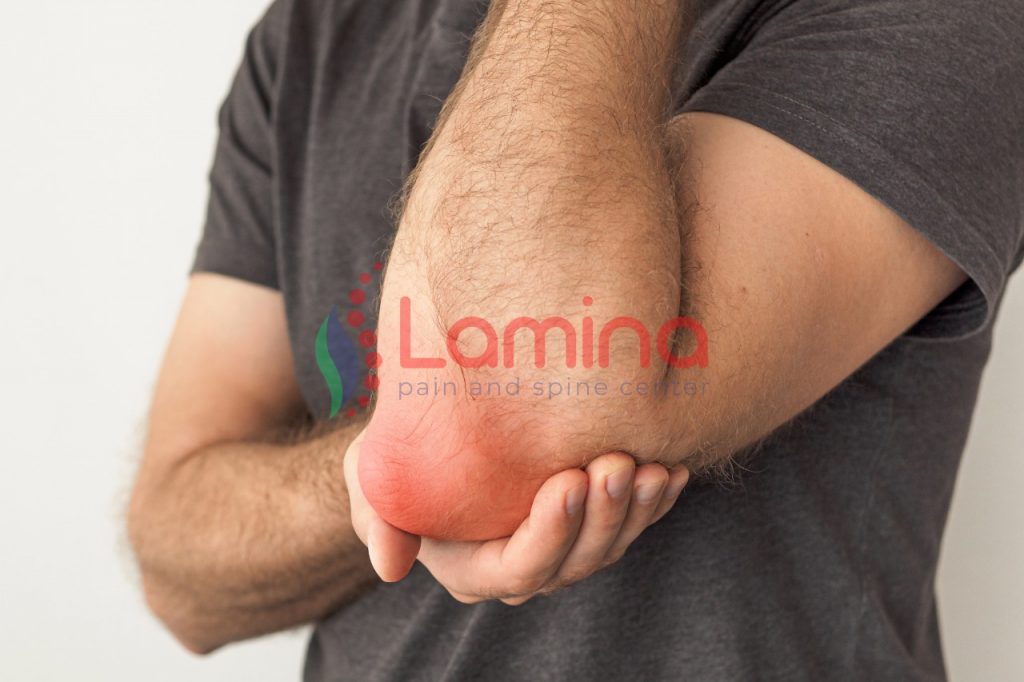 dislokasi sendi tulang siku